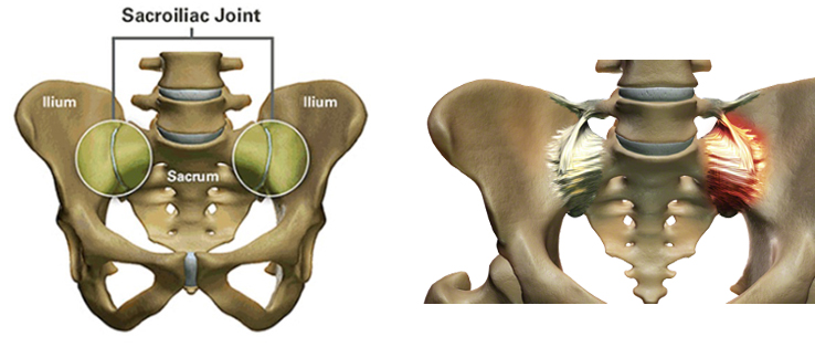 sacroiliac & pelvic pain